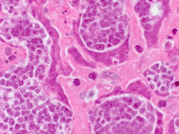 A person's parasite research