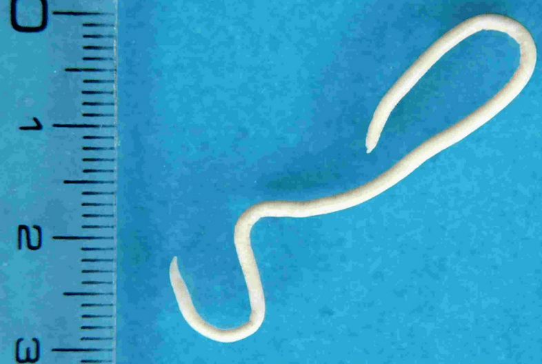 Description of human parasites