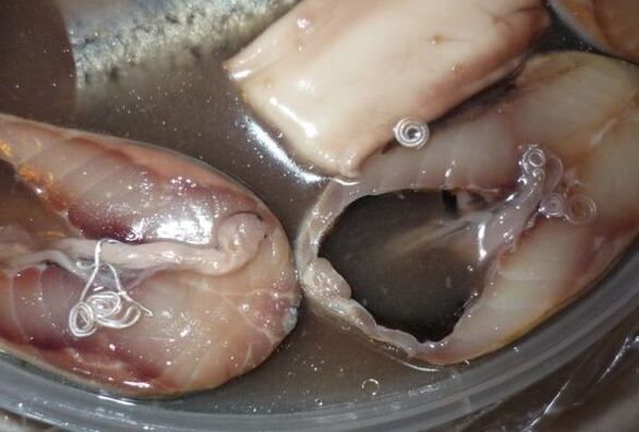 How humans become infected with parasites