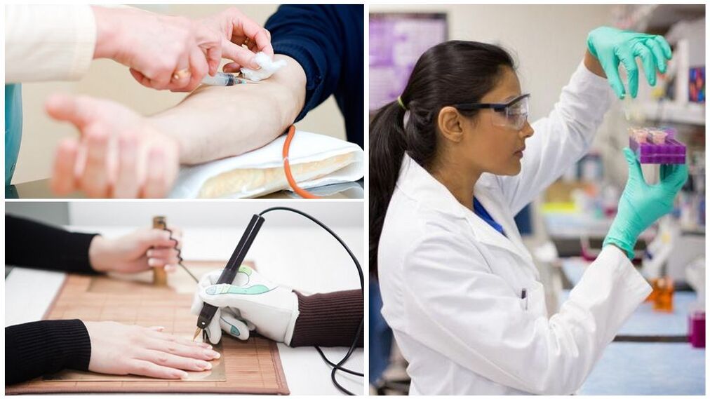 Diagnostic methods to detect internal parasites