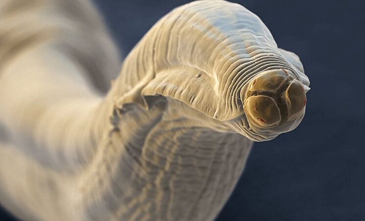 helminth parasites from the human body