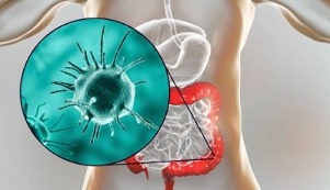 What tests should be done for parasites