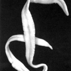 Ribbon parasites in human body