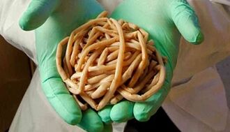 How to eliminate parasites from the body