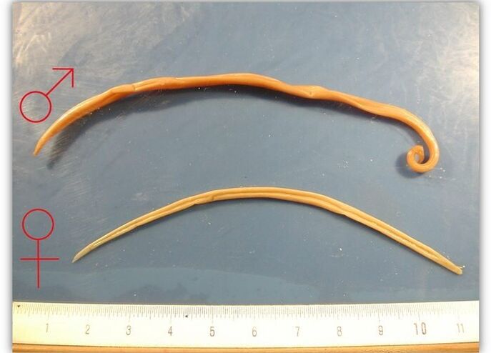 Size of roundworms - the worms that infect the adult respiratory tract