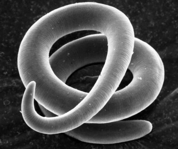 Trichinella spiralis under the microscope