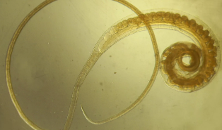 Trihozefalez trichuris trichuris